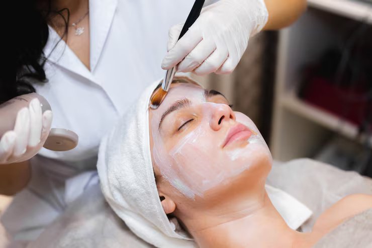 Vampire Facial
